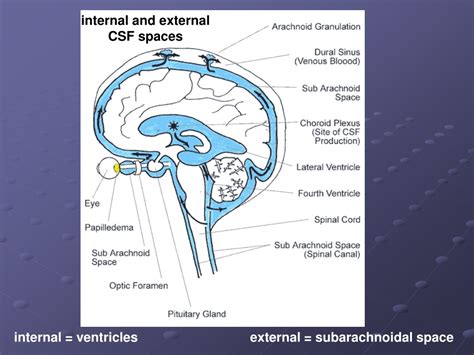 prominent retrocerebellar csf space